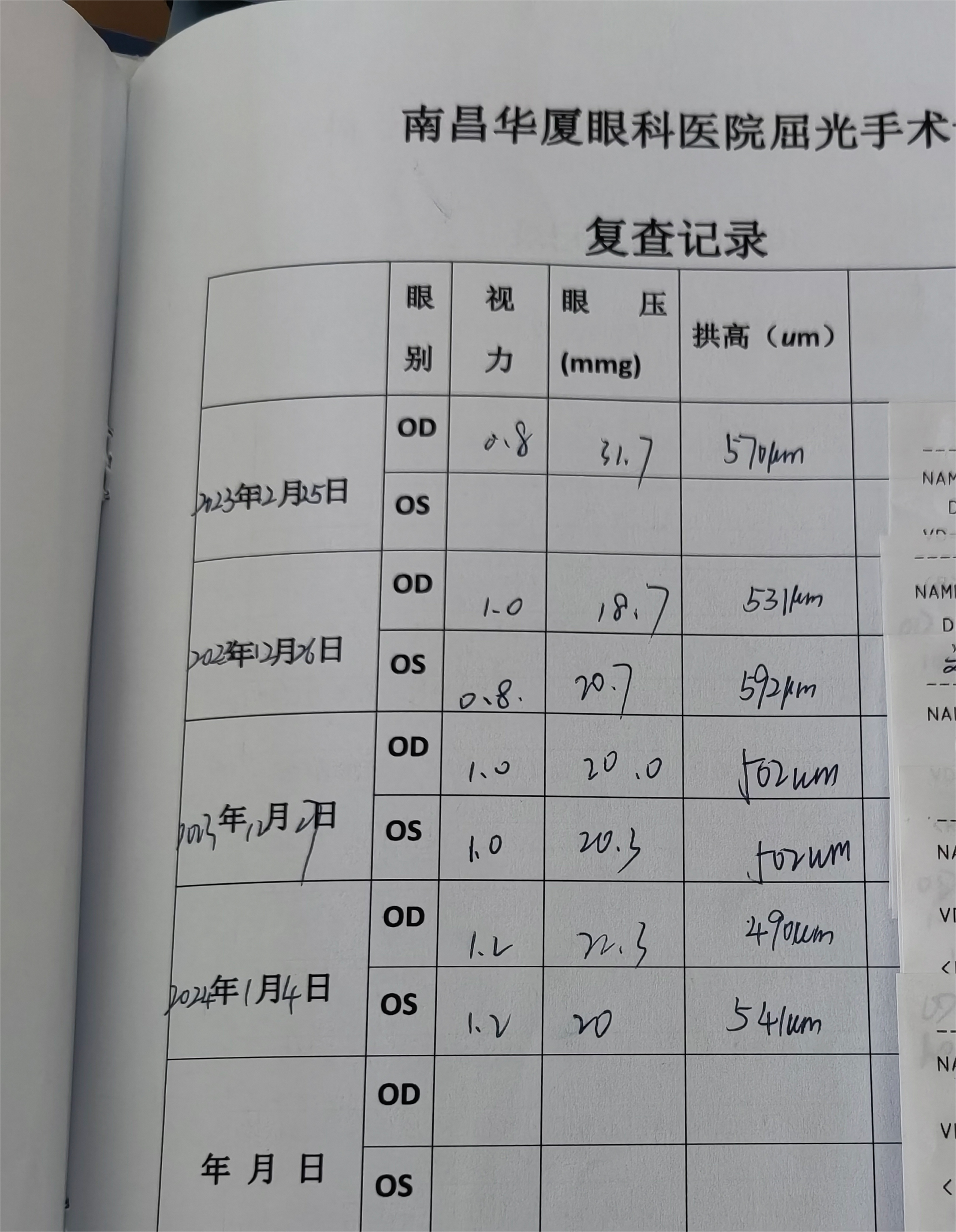 关于南昌icl近视手术的经验分享(术后2个月视力1.2)_眼睛_晶体_散光