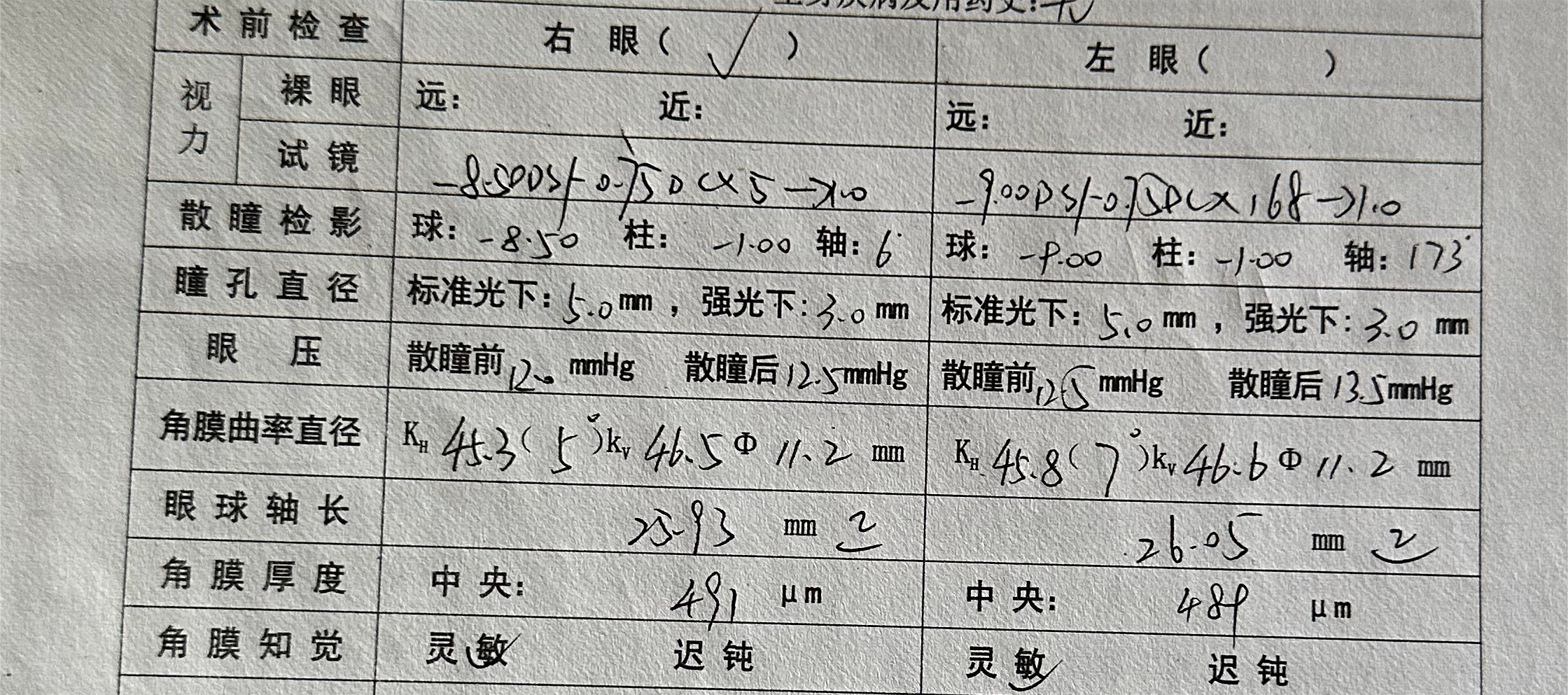 16岁眼睛近视500度图片