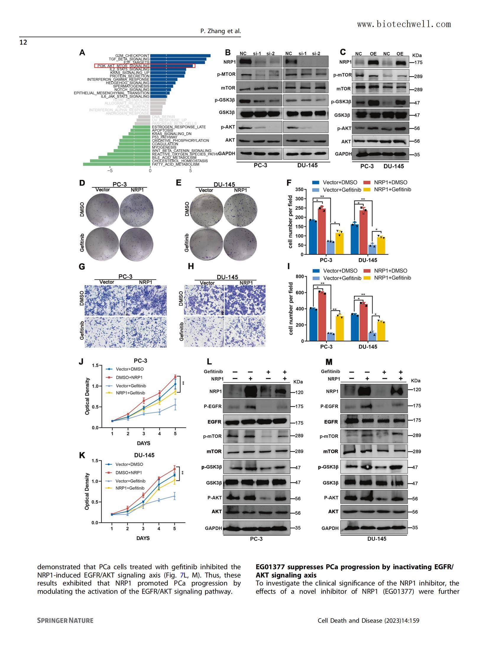上海威奥前列腺癌组织芯片文献13