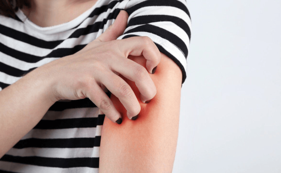 皮肤过敏的原因有哪些经常过敏怎么办