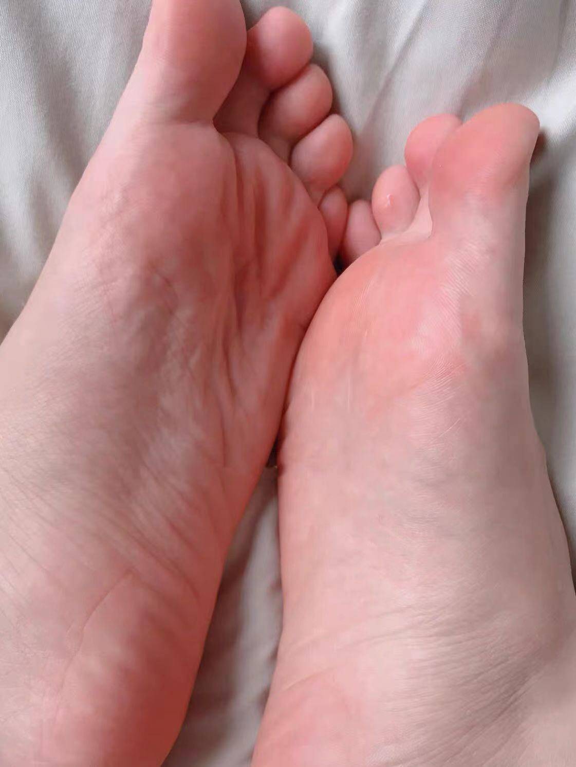 分享真实脚气产品测评,跟着过来人选,轻松告别脚气_效果_药膏_过程
