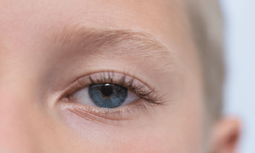 孩子散瞳后用不用请假在家休息等恢复