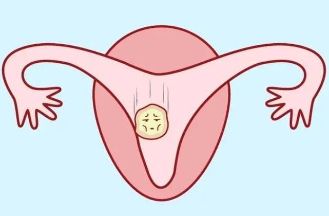 红木坊朱秀英医生:什么样的子宫内膜更适合怀孕？_胚胎_厚度_形态