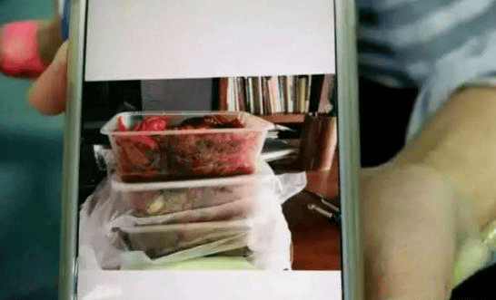 原创吃完小龙虾后女子全身肌肉痛发冷送医后横纹肌溶解综合征