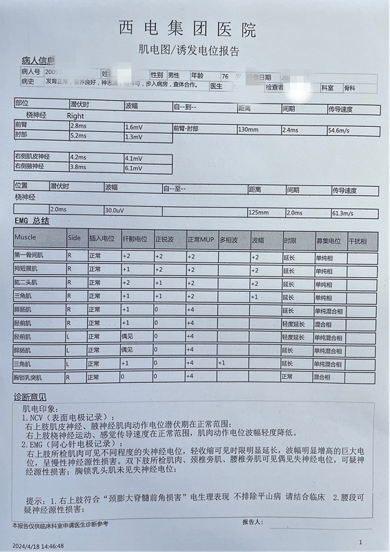 罕见病揭秘:西电医院多学科团队解锁"平山病"之谜