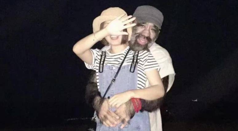 当年轰动一时的"毛孩":42岁娶90后娇妻,生下一子未遗传长毛