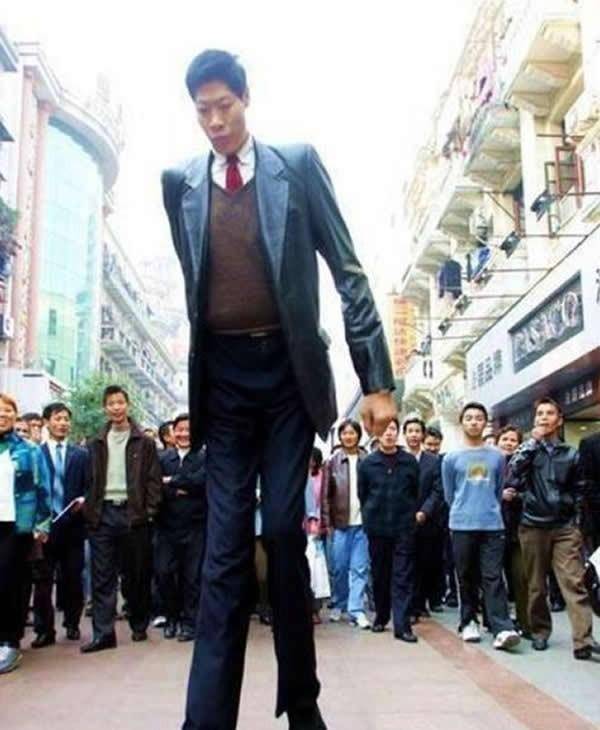 22年前,身高2米42的张俊才娶了1米65的妻子,如今怎么样了