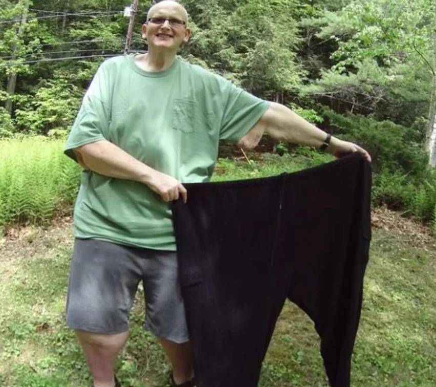 2001年544斤英国男子被拆墙送医,医院:若去世只能送屠宰场火化