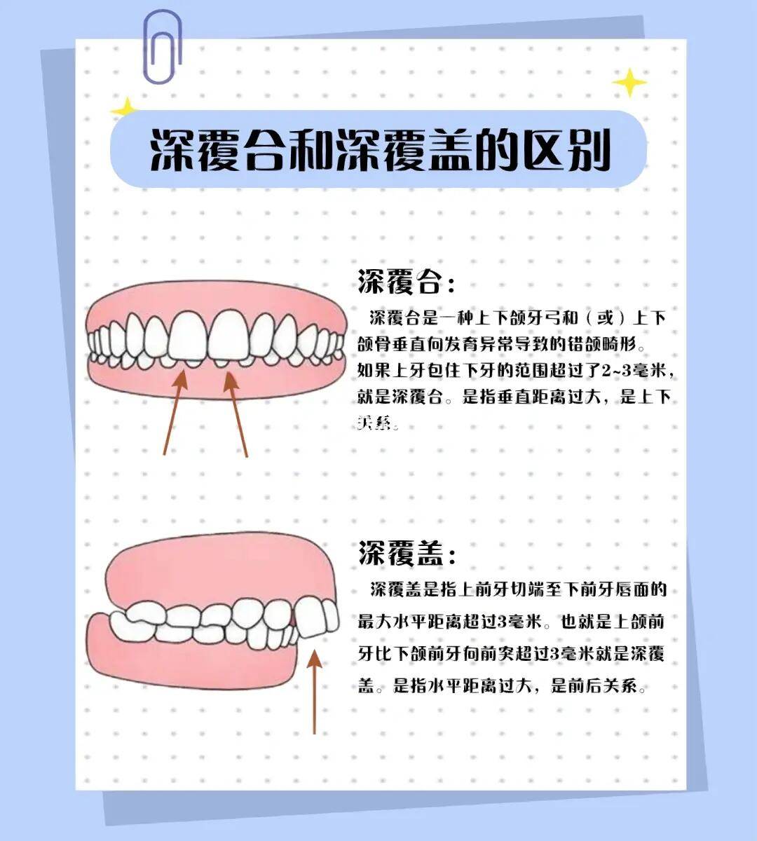 邢台正畸专家带你了解它们的区别与影响_咬合_距离_前牙