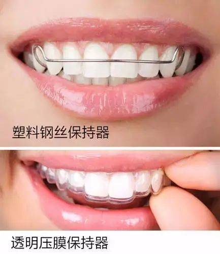 一,相同点宏皓口腔-固定矫治器和隐形矫正器在口腔医疗领域中,牙齿