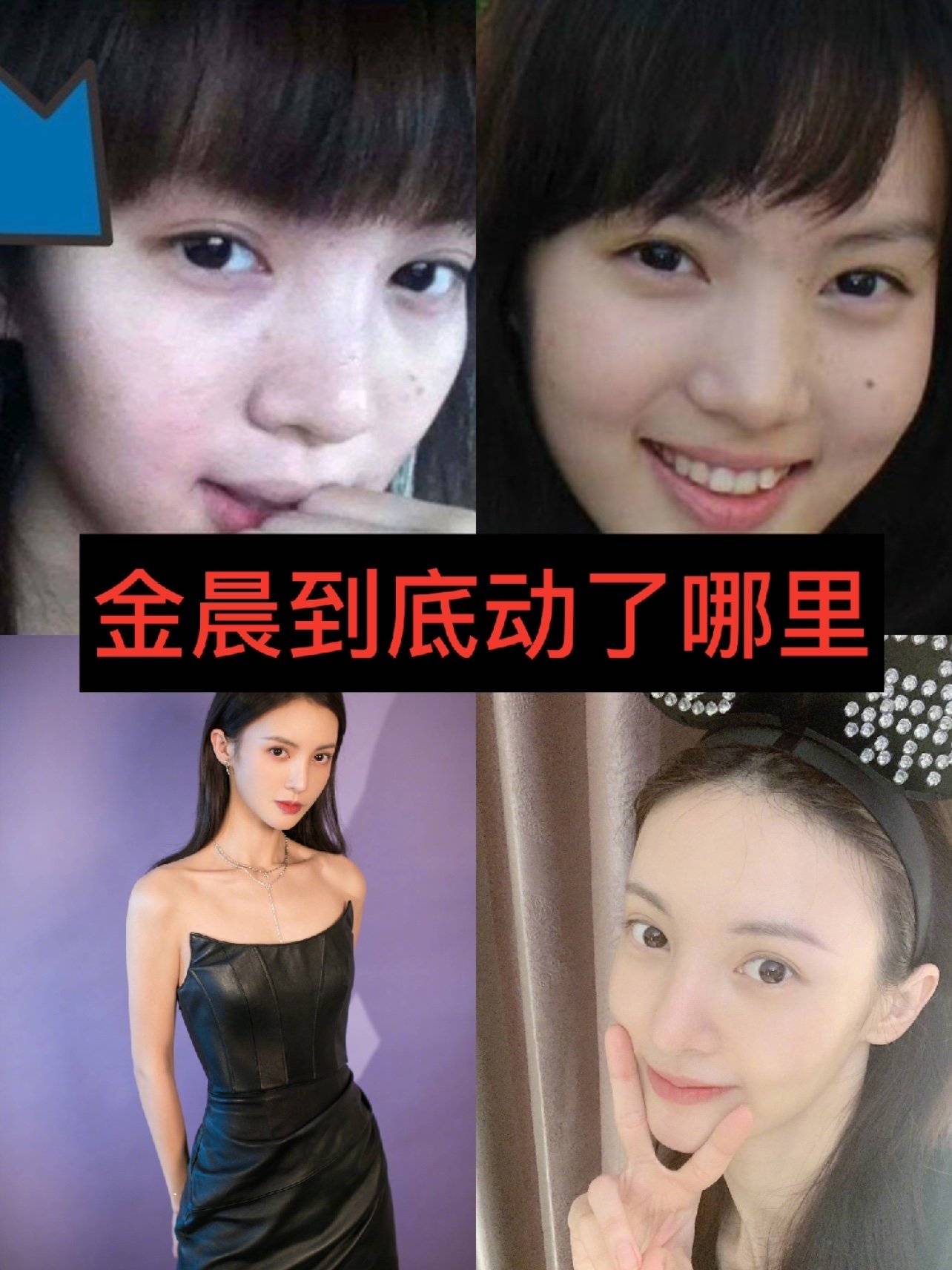 金晨惊人蜕变:整容前后大揭秘!