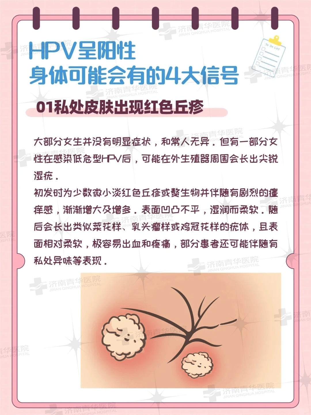 hpv阳性者常合并阴道炎