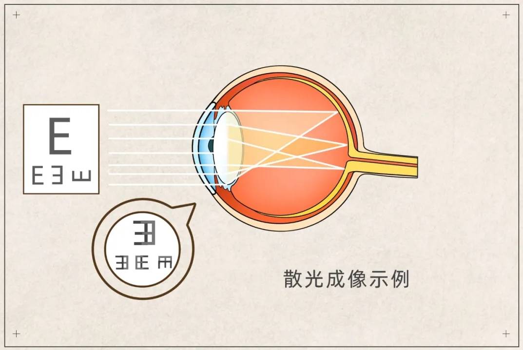 散光300度看到的图片图片