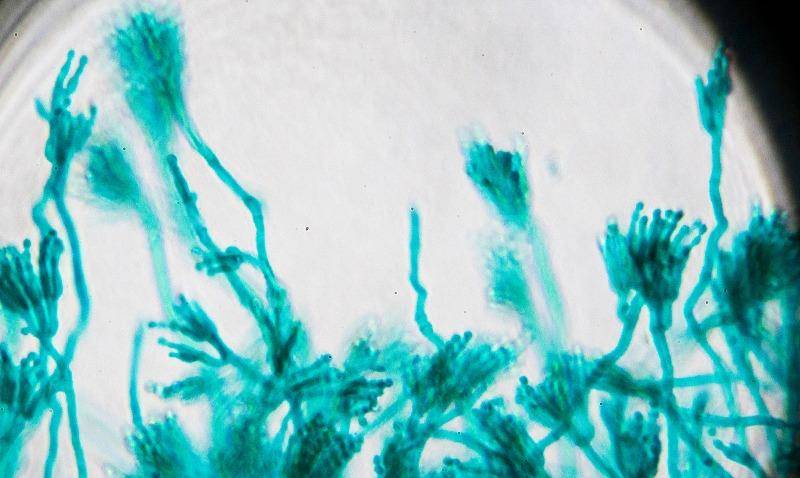 20世纪医学界最伟大的创举之一:青霉素是在什么情况下发明的?