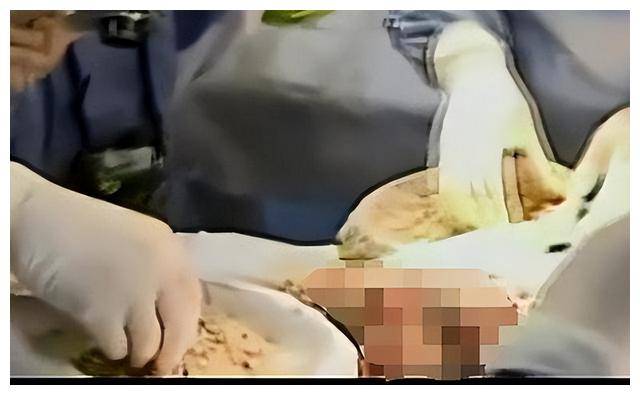 就像张月用10万只蛆虫重拾生命一般,只要坚持不放弃