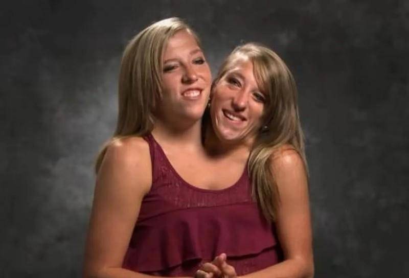 美国连体姐妹:共用一个身体,拿到驾照当上老师,31岁渴望结婚