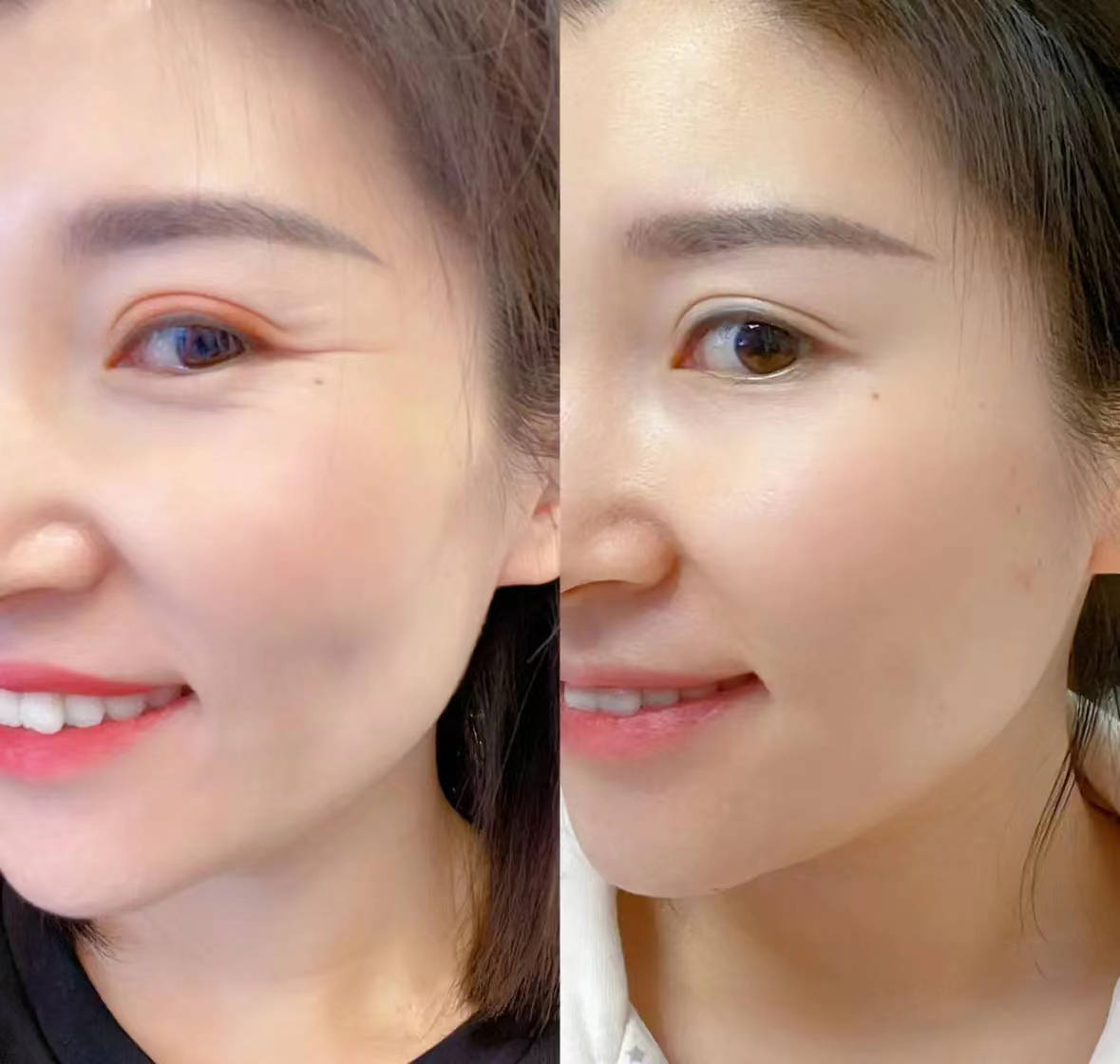 眼霜那个牌子的去眼纹和紧致眼袋?揭秘:霸榜热销款眼霜测评