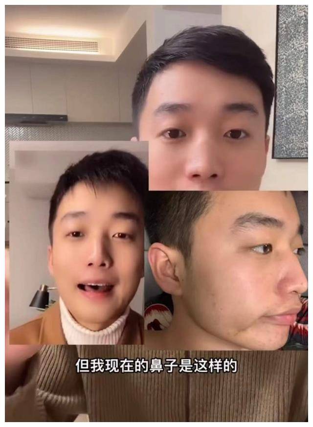 男网红咽喉不适去医院检查,毫不知情被"整容",鼻子坍塌惨毁容