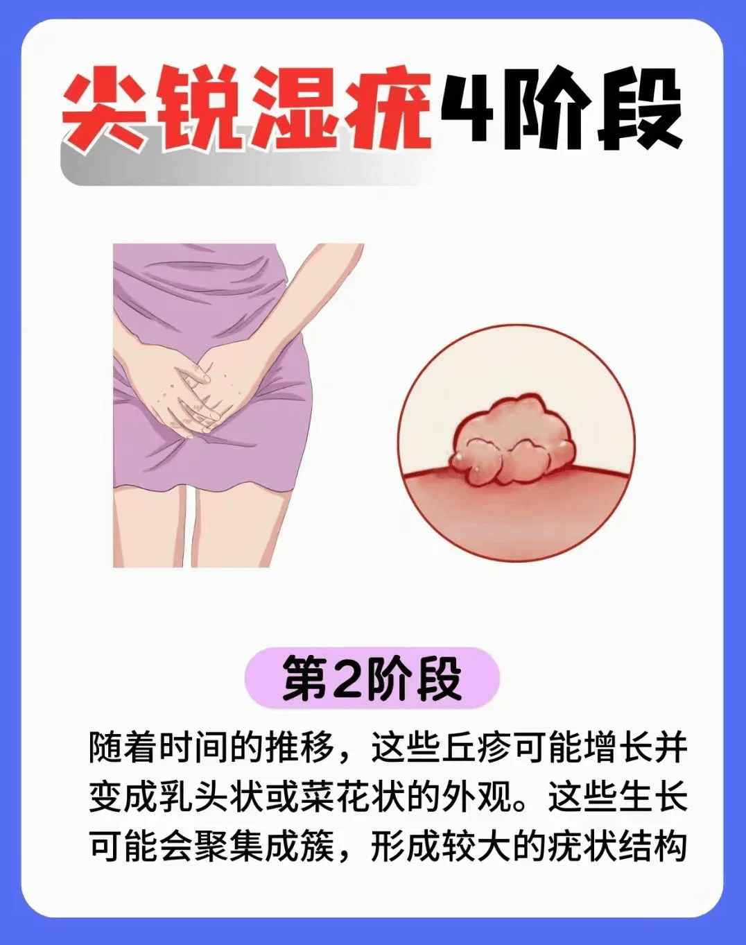 乳头痒是什么原因图片