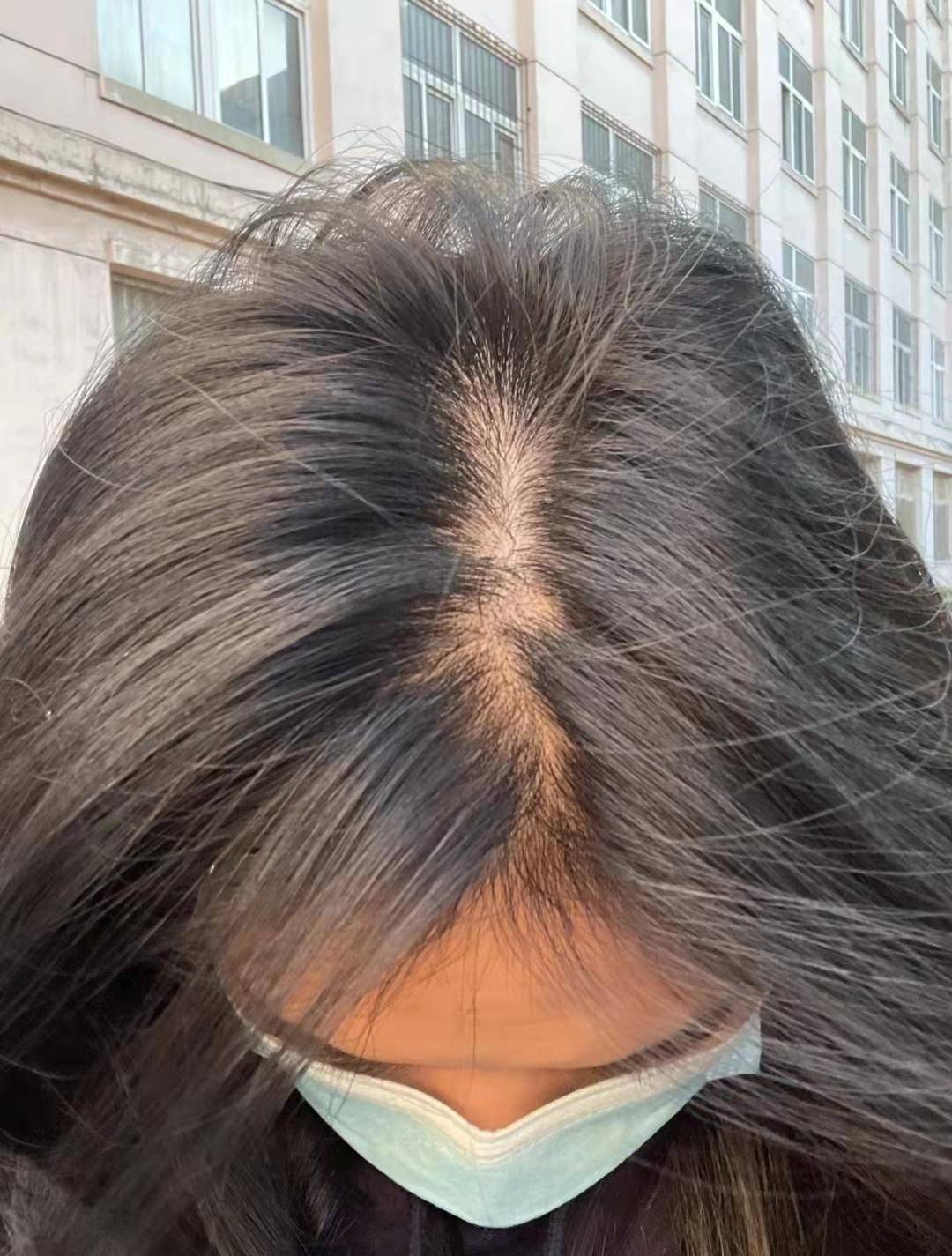 宿迁楚街皮肤病医院专家来支招!