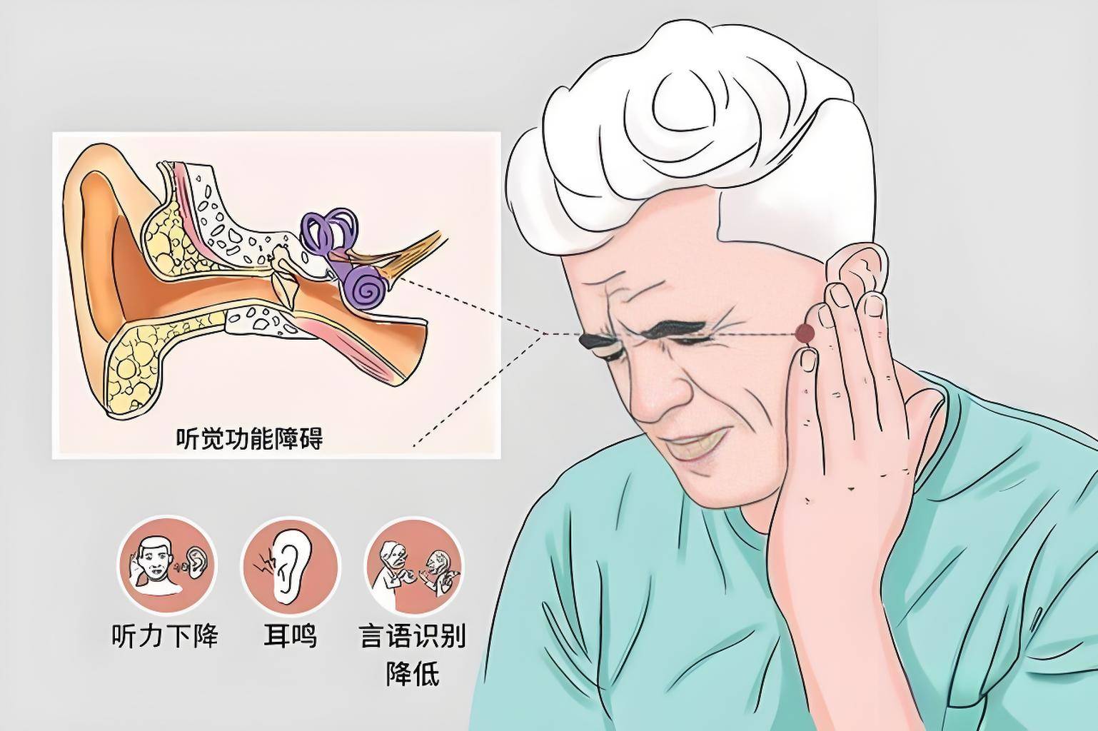 肿瘤专家马晓东：听神经瘤治疗全攻略_手术_患者_症状