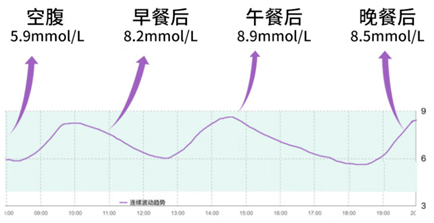 血糖波动图24小时图片