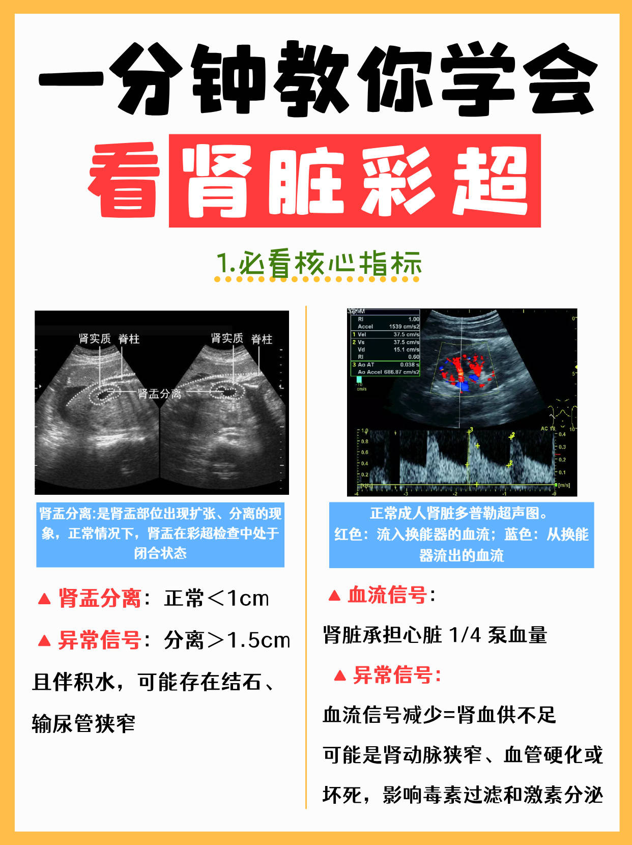 ▫️肾囊肿:肾脏里的"小水泡",单发且<5cm定期观察即可.2️ 6