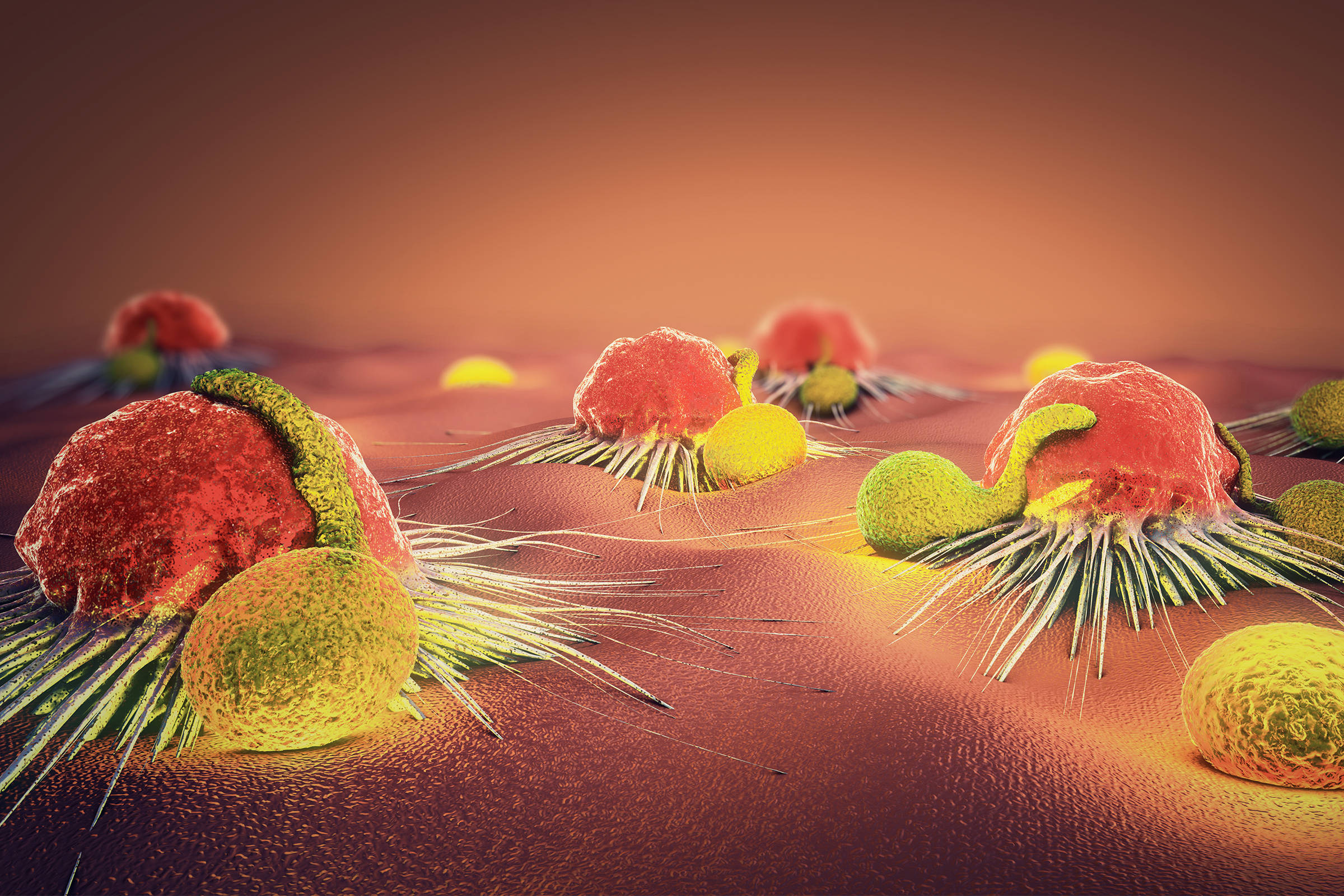 胆管癌化疗效果不明显怎么办?还有办法治疗吗