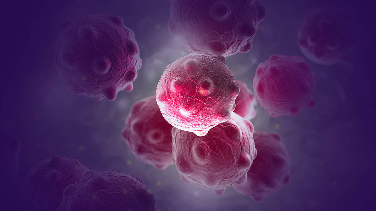 晚期肺鳞癌中药治疗怎样?能控制病情吗