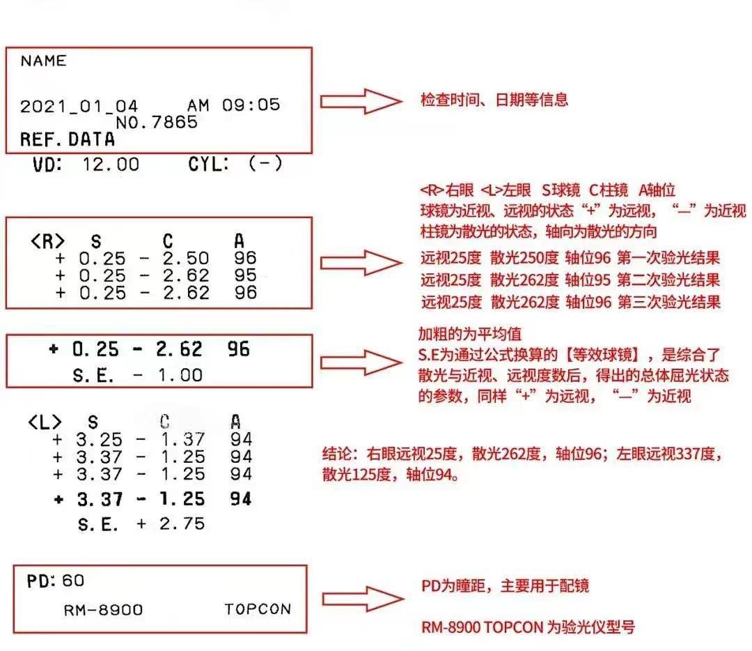 解碼電腦驗光單,讀懂只需1分鐘_檢查_視力_孩子