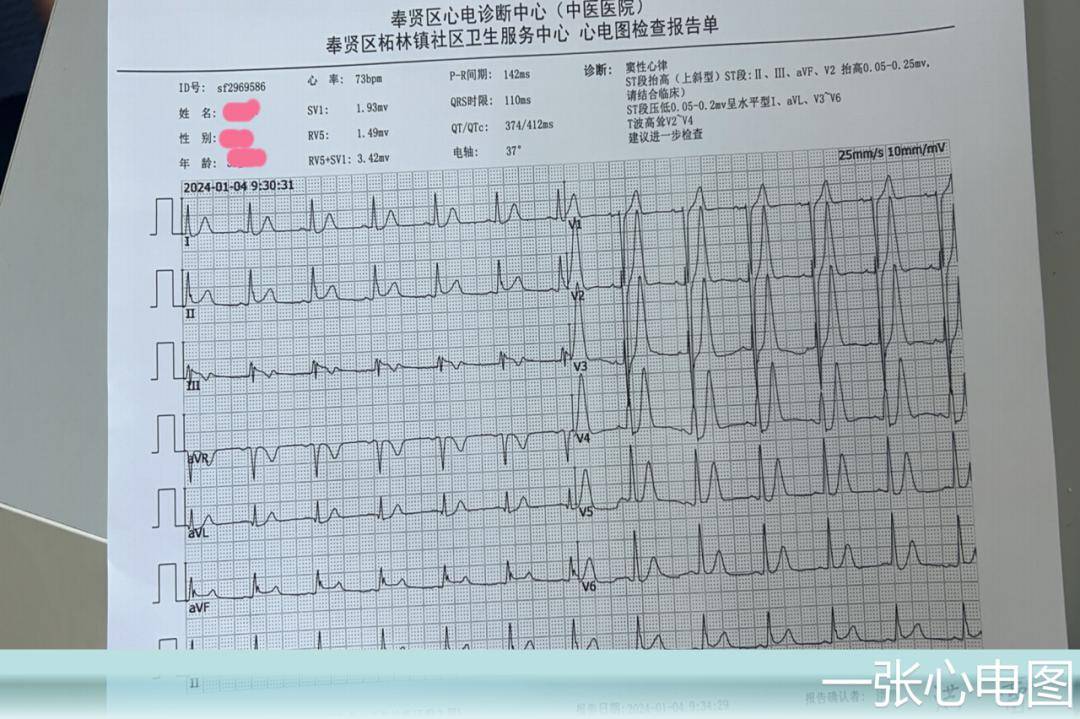 32歲的年輕生命突發心梗,上演