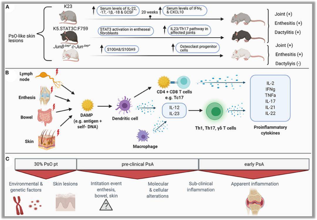 一文解讀 | 深度探討早期銀屑病關節炎的免疫學發病機制_患者_臨床