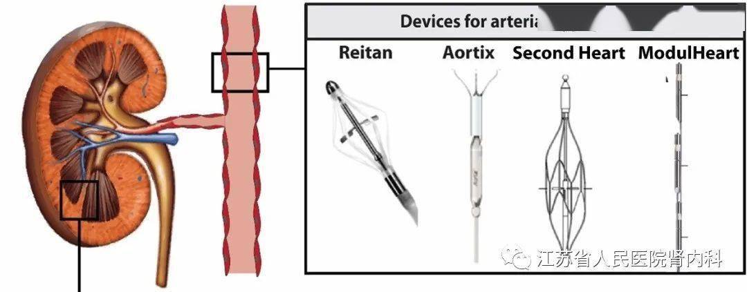 2023年腎臟病學新進展10|急性腎損傷_手術_氧氣_al