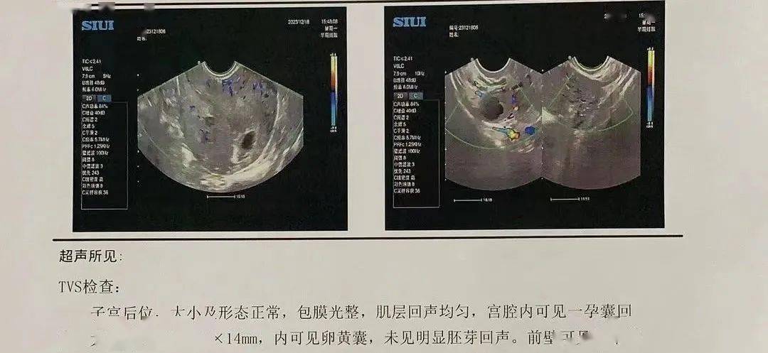 因為_感覺_孩子