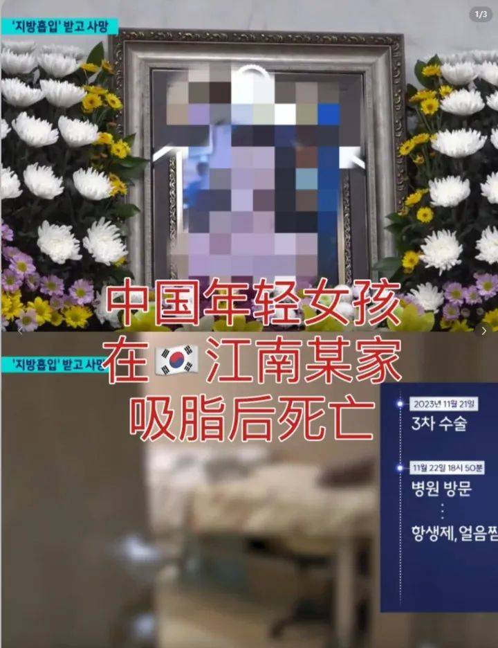 20多岁中国女子赴韩抽脂后死亡!警方介入_江南_手术_女孩
