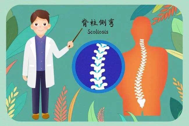 關注脊柱側彎,守護健康脊樑disease prevention什麼是青少年脊柱側彎