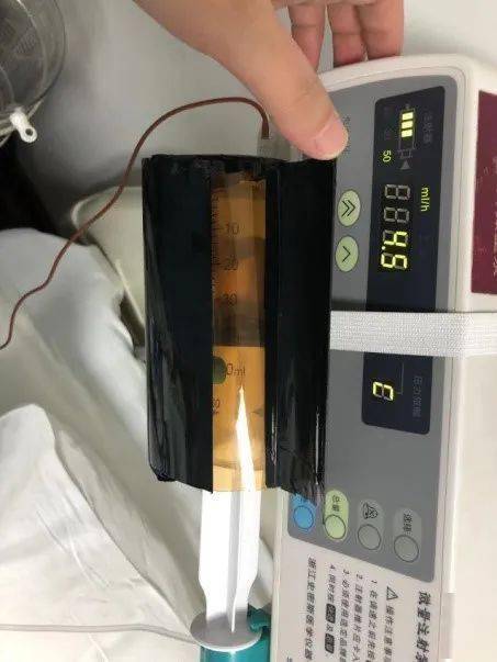 护理·创新:注射器避光装置_剩余_患者_影响