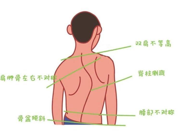 手摸肩胛骨一凸一平图片