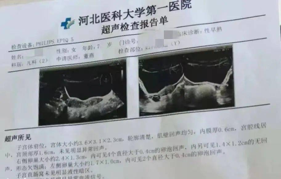 很多人家里都有!