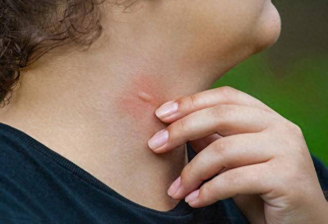 身体出现以下四种症状,千万要注意了,有可能是寄生虫感染_问题_风险