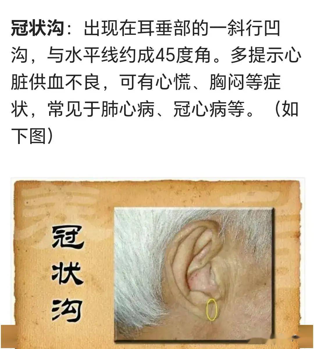 耳朵藏在很多人不知道的秘密,建议收藏!