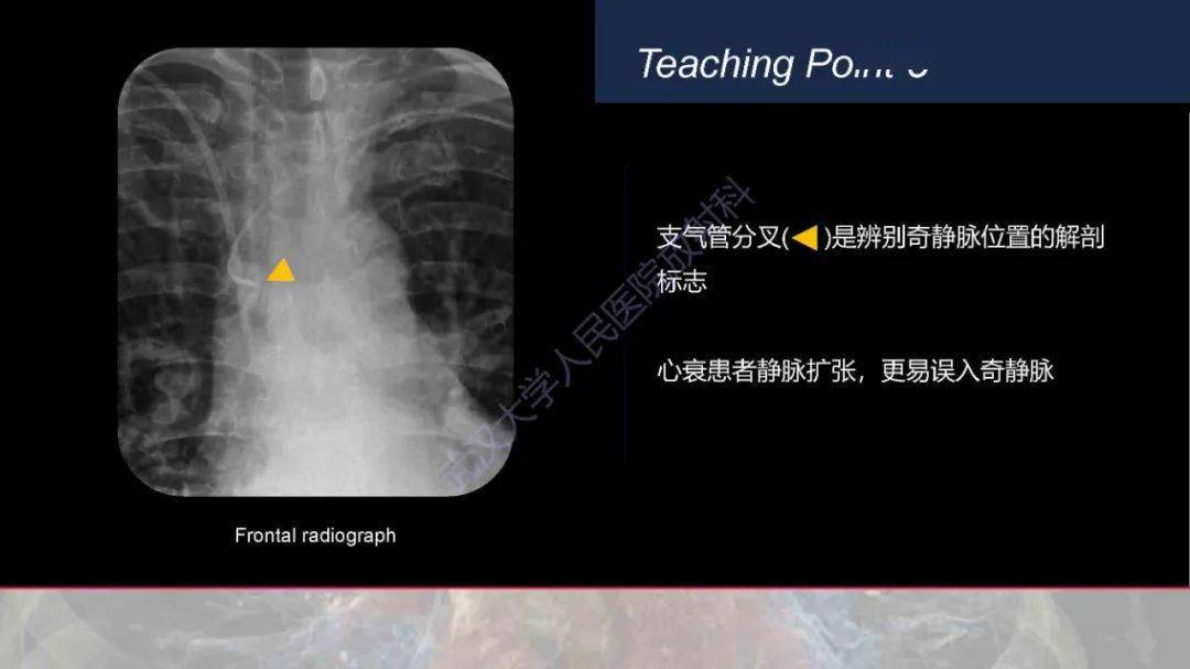 中心靜脈置管影像學評估_流程_關懷_服務