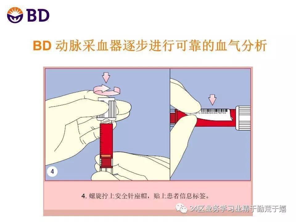 采血器怎么用图片