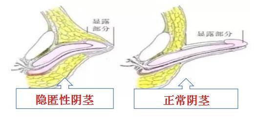 小孩的小鸡 隐匿图片