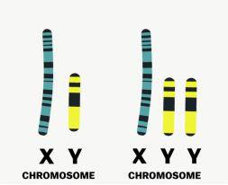 xyy染色体的人照片图片