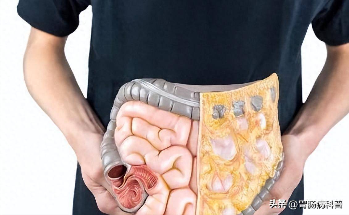 大便前头干硬,后头软粘,是身体的什么信号?看完惊呆了!