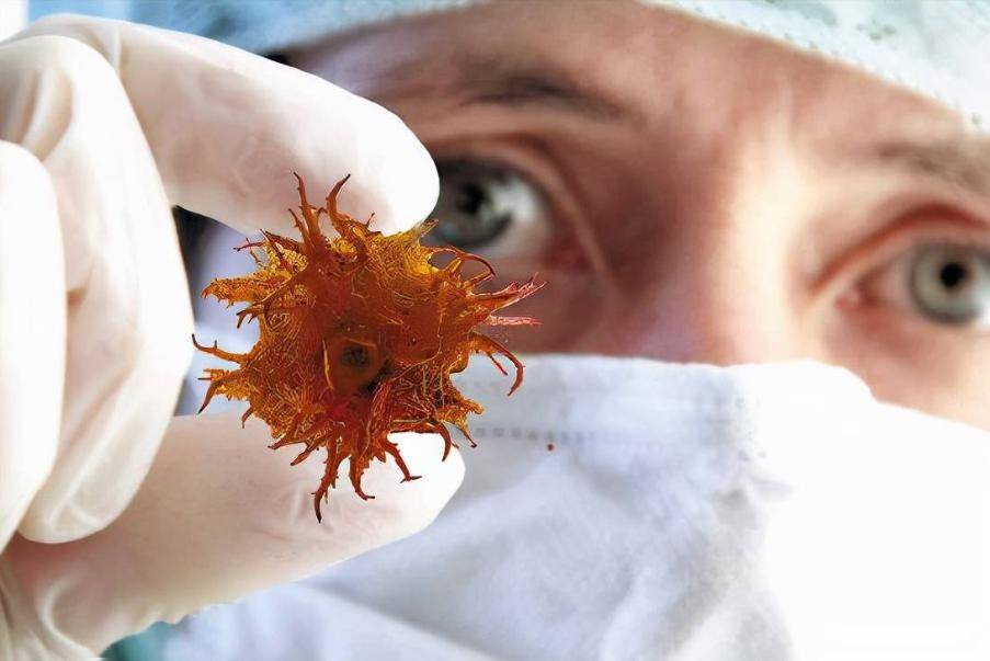 a型,b型,o型,ab型,哪种血型更容易?