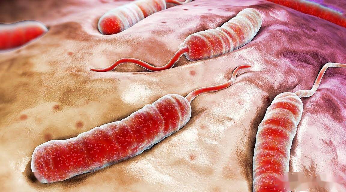 霍乱是怎么回事?_小肠_传播_细胞