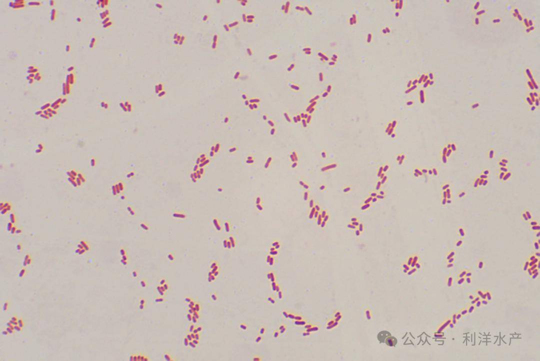 肺炎双球菌荚膜特点图片