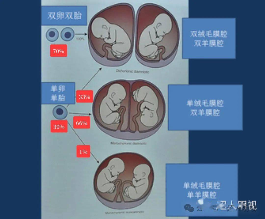 异卵双胞胎什么意思图片